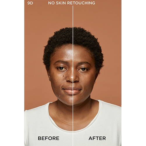 9W TERRE Before After 500px